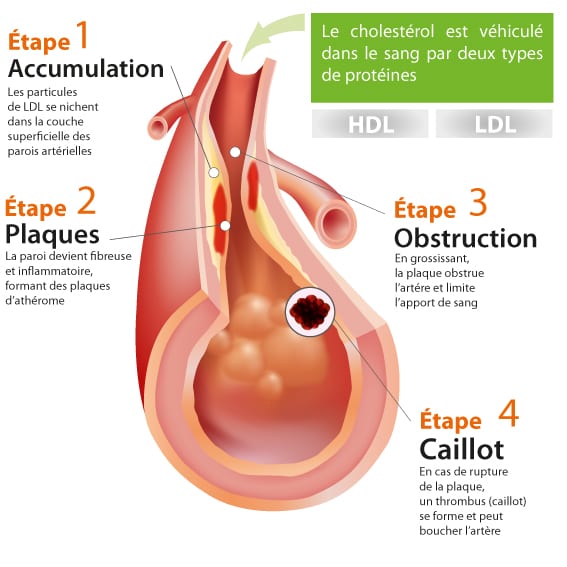 bon et mauvais cholesterol